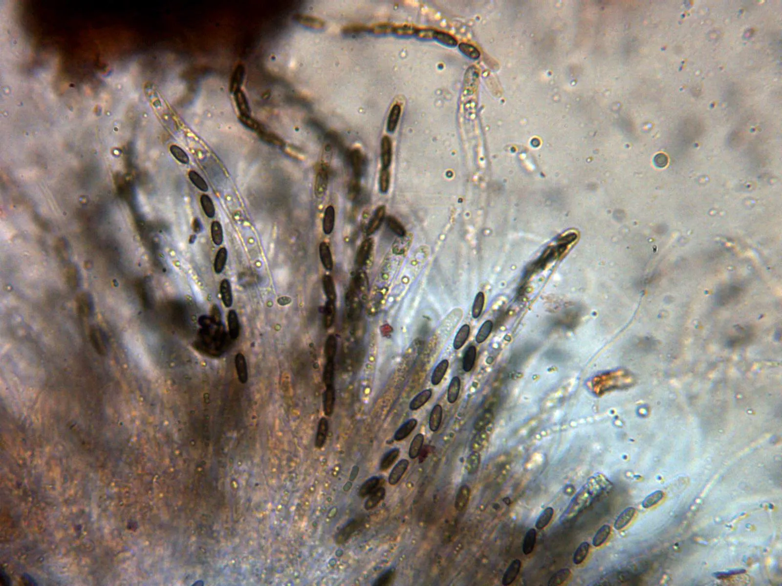 Microscopía de Lopadostoma quercicola - 13 - Ascas x 400